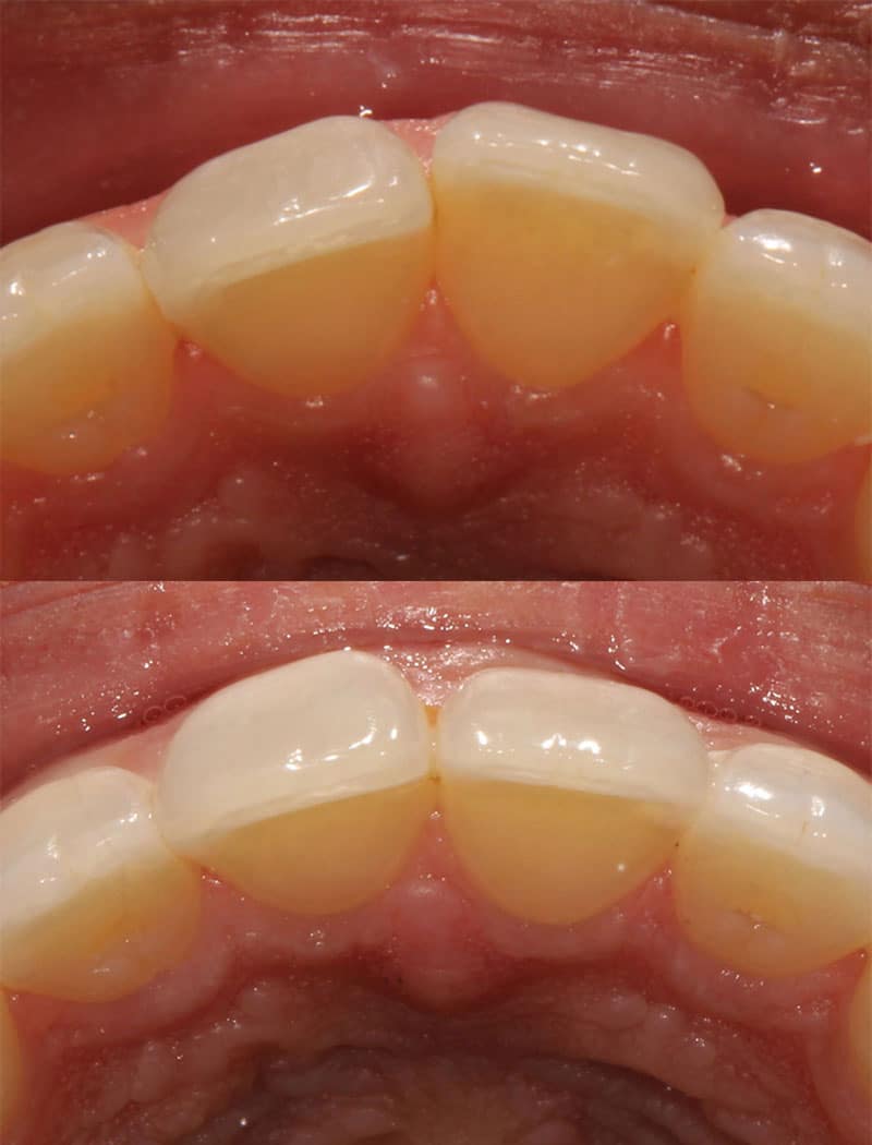 Orthodontic Example 1