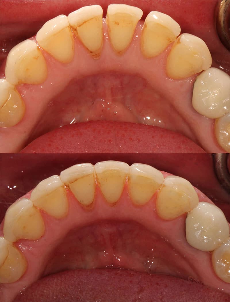 Orthodontic Example 2