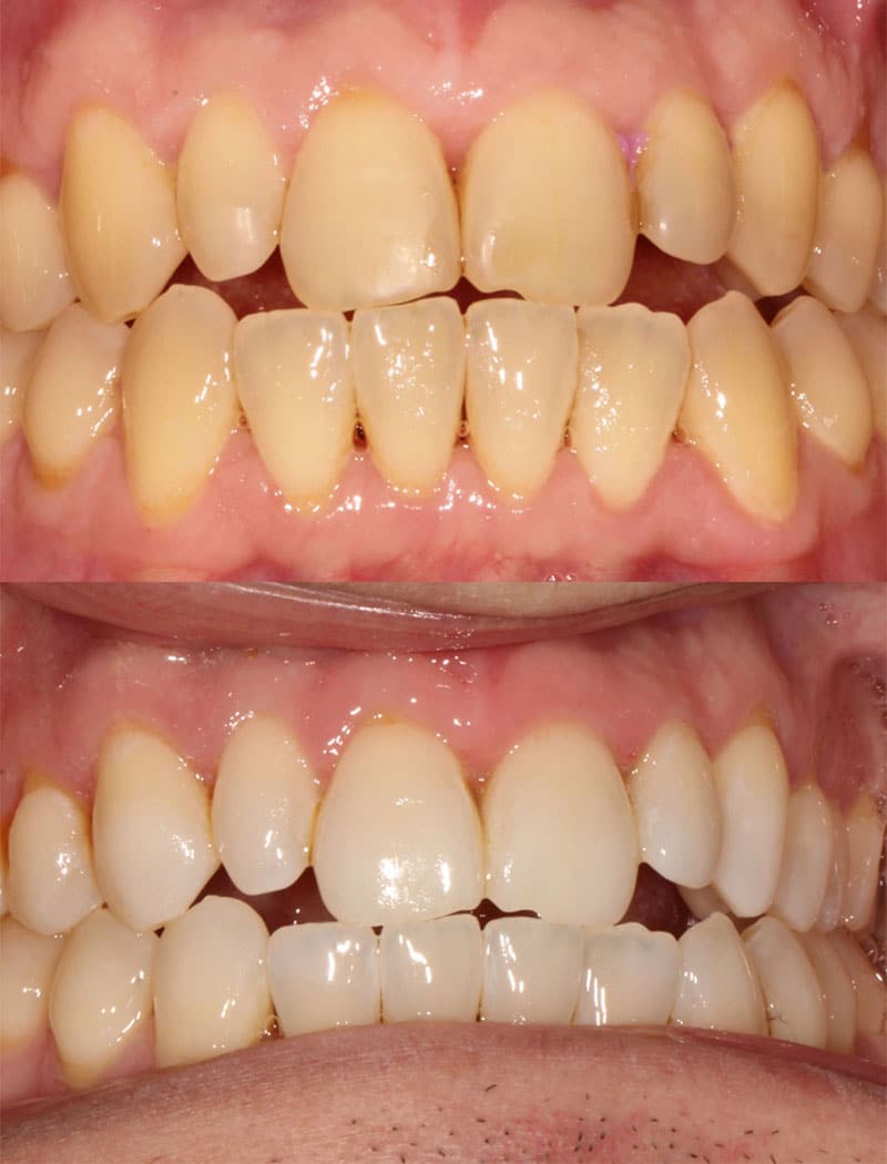 Whitening Example