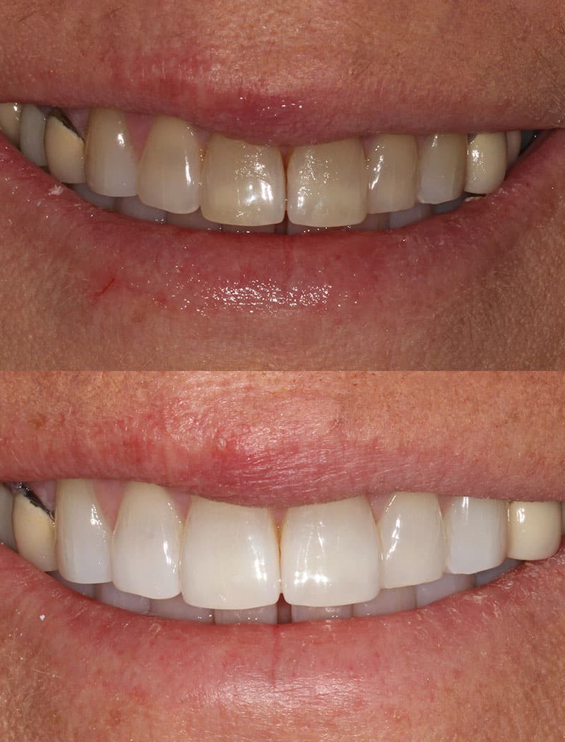 Whitening Example