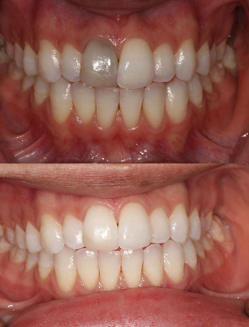 Whitening Example