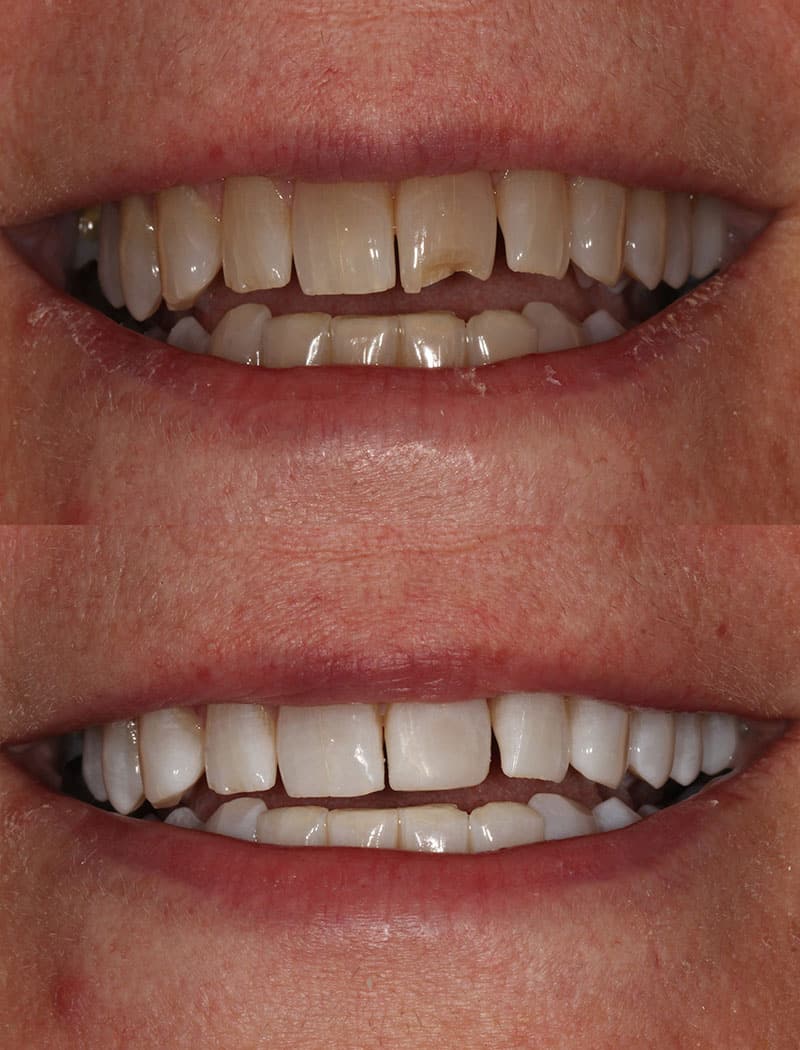 Whitening Example