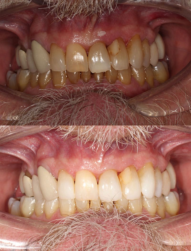 Whitening Example